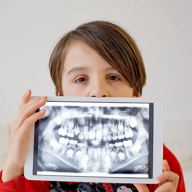 Digital Dental X-Rays
