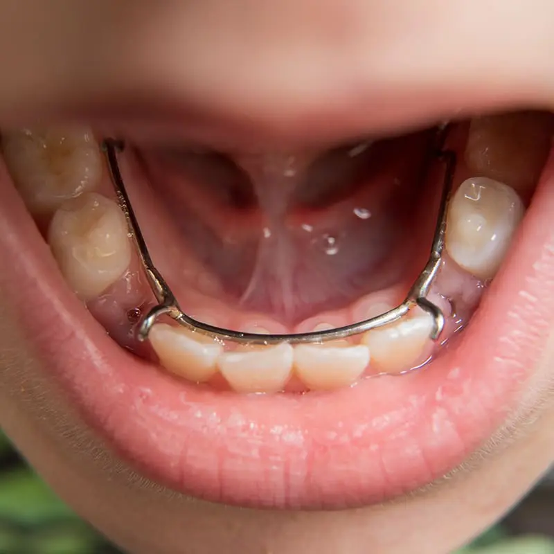 Akoya Pediatric Dentistry Office