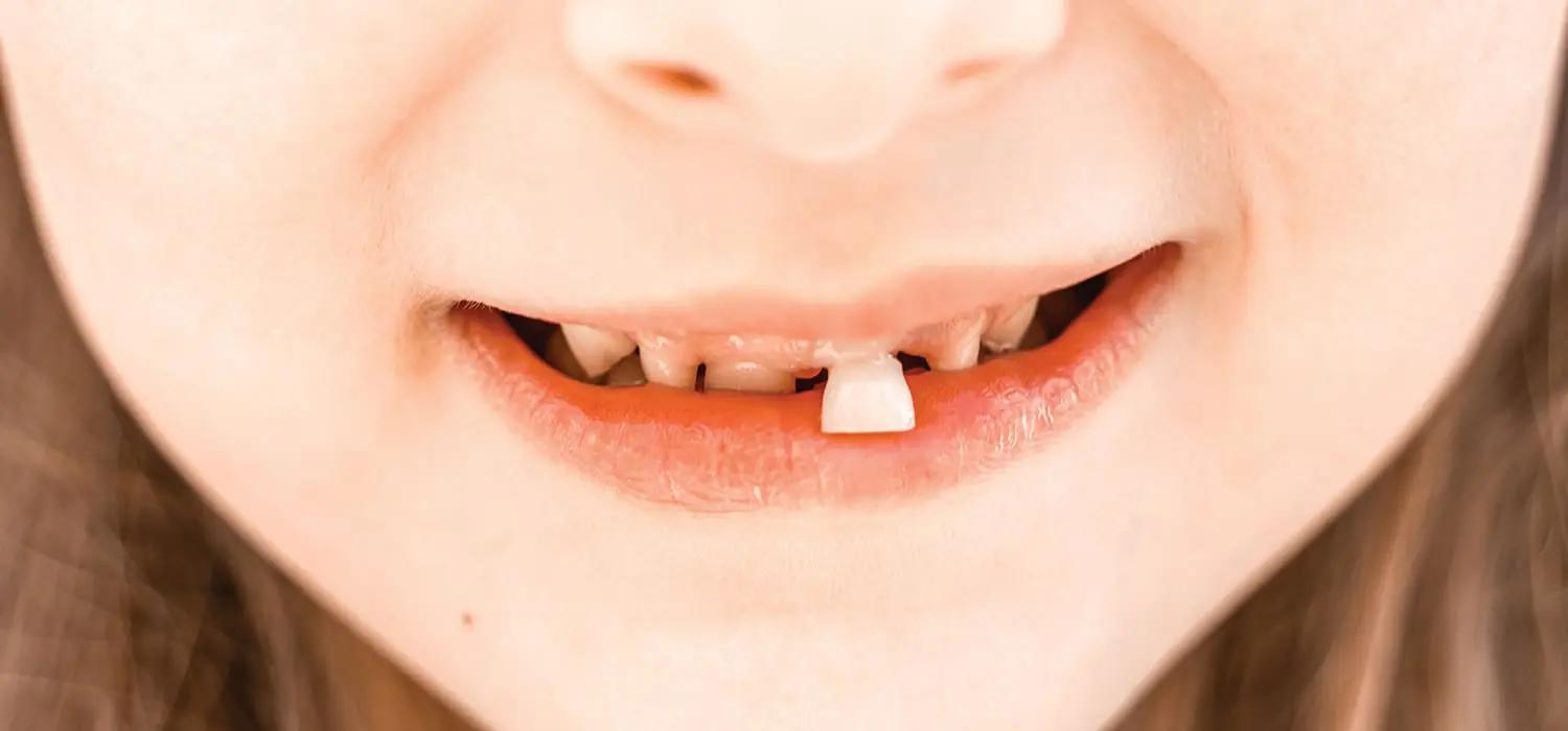 What Happens If a Baby Tooth Falls Out Too Early?