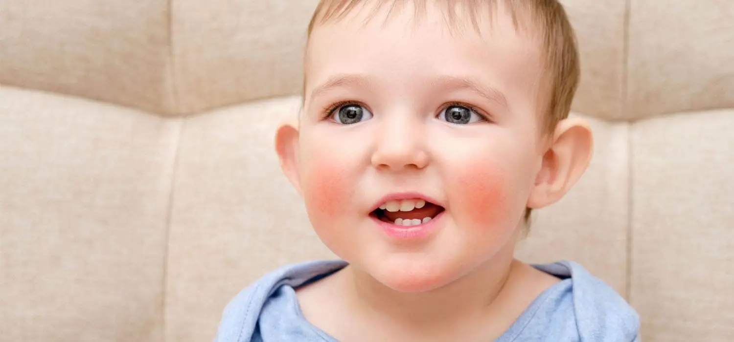 Red Cheeks and Teething: What’s Normal and What Isn’t?