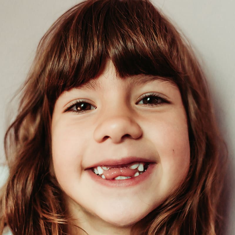 Tooth Eruption & Shedding Tooth Eruption & Shedding