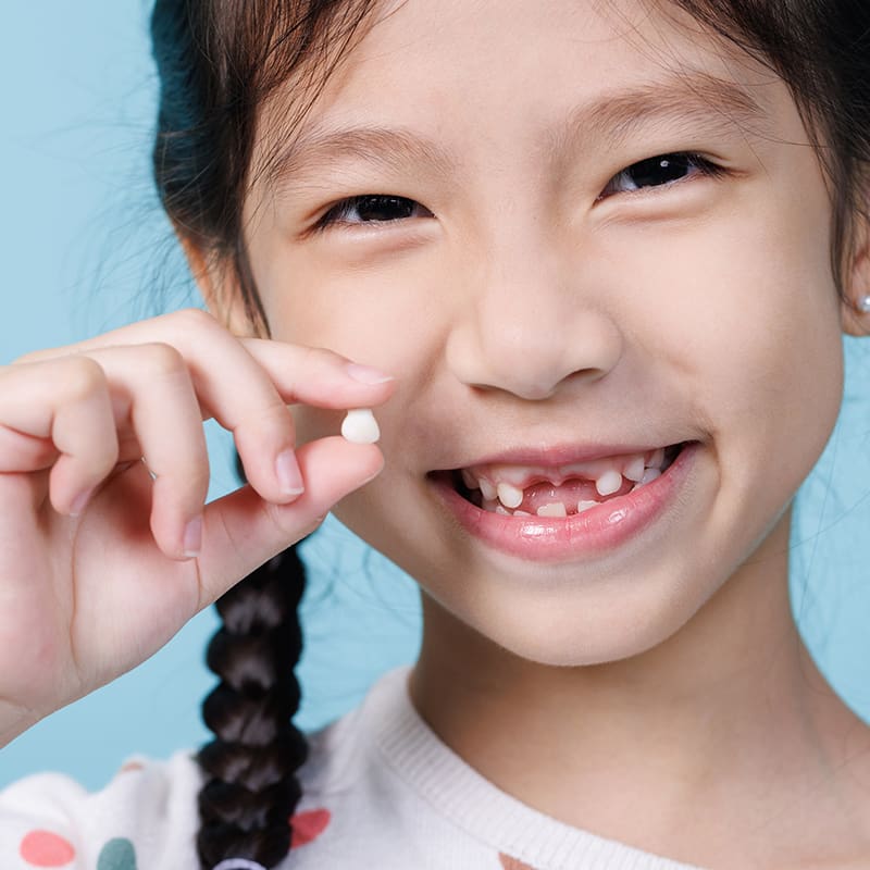 Tooth Extractions