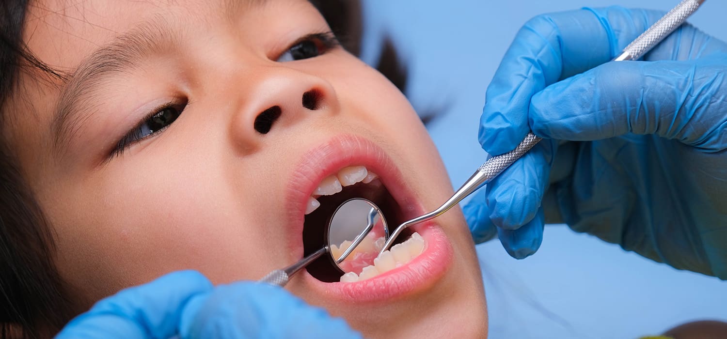 Why Your Child May Have a Black Spot on Their Gums